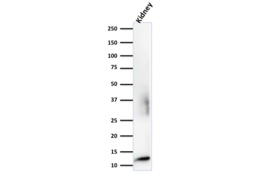 Western Blot - Anti-beta 2 Microglobulin Antibody [rB2M/961] (A249753) - Antibodies.com