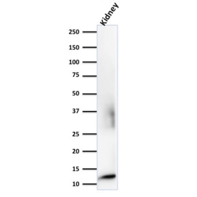 Western Blot - Anti-beta 2 Microglobulin Antibody [rB2M/961] (A249753) - Antibodies.com