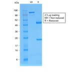 SDS-PAGE - Anti-beta 2 Microglobulin Antibody [rB2M/961] (A249753) - Antibodies.com