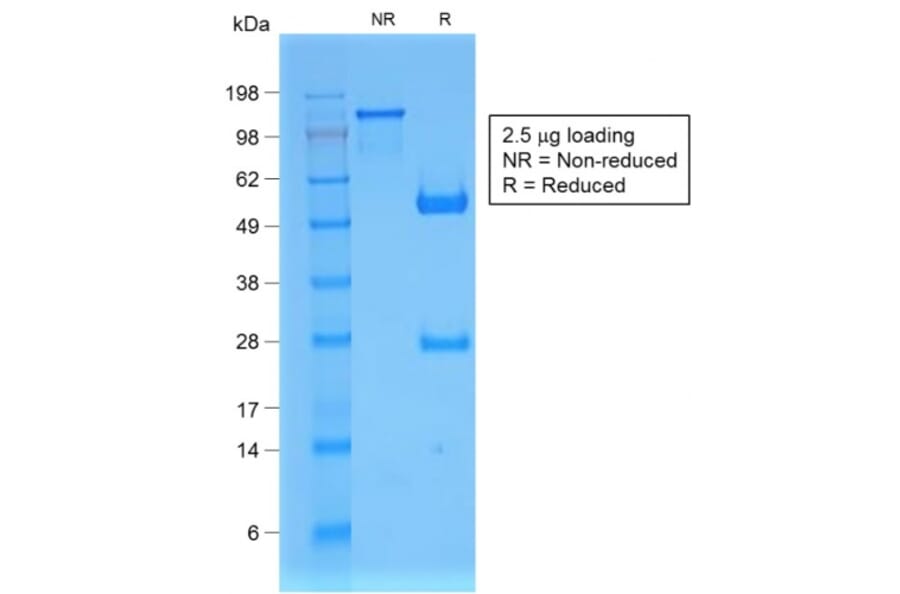 SDS-PAGE - Anti-beta 2 Microglobulin Antibody [B2M/1857R] (A249754) - Antibodies.com