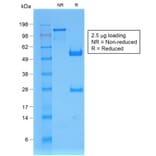 SDS-PAGE - Anti-beta 2 Microglobulin Antibody [B2M/1857R] (A249754) - Antibodies.com
