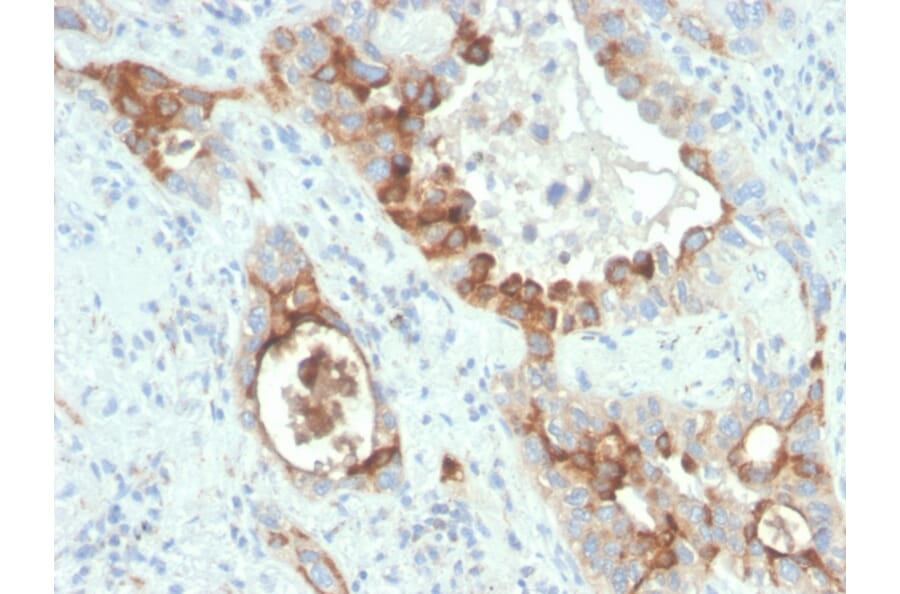 Immunohistochemistry - Anti-PMEPA1 Antibody [rPMEPA1/6422] (A249754) - Antibodies.com
