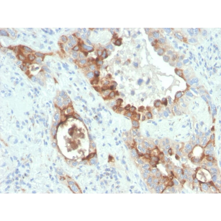 Immunohistochemistry - Anti-PMEPA1 Antibody [rPMEPA1/6422] (A249754) - Antibodies.com