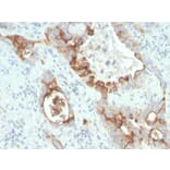 Immunohistochemistry - Anti-PMEPA1 Antibody [rPMEPA1/6422] (A249754) - Antibodies.com