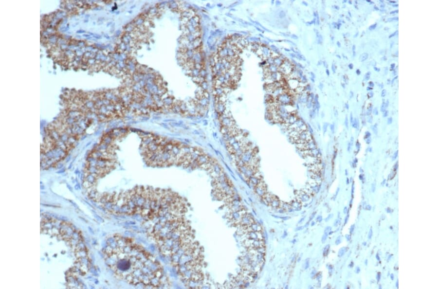 Immunohistochemistry - Anti-PMEPA1 Antibody [rPMEPA1/6422] (A249755) - Antibodies.com