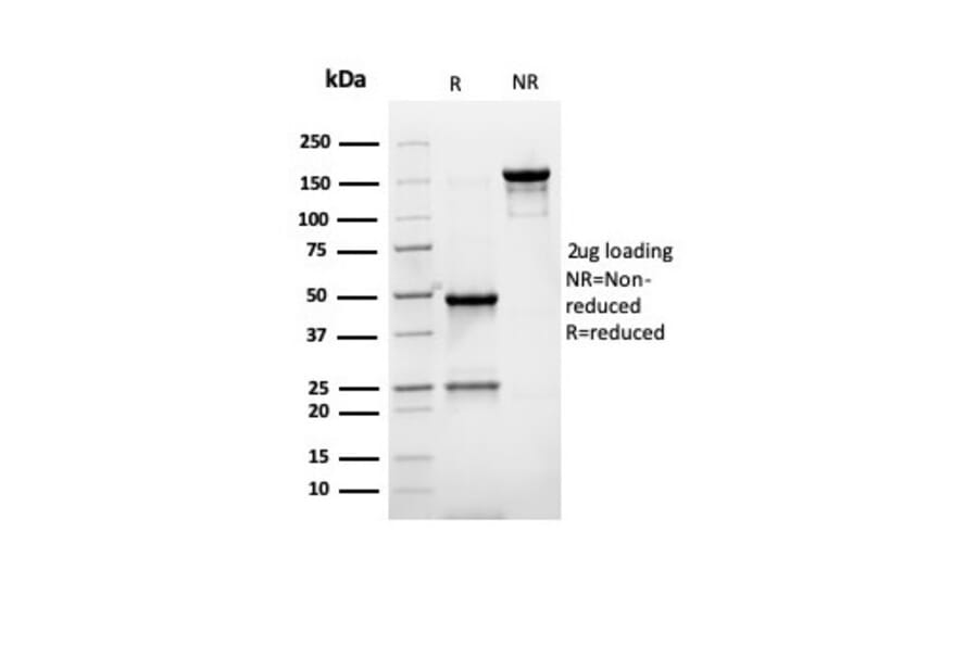 SDS-PAGE - Anti-PMEPA1 Antibody [rPMEPA1/6422] (A249755) - Antibodies.com