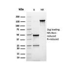 SDS-PAGE - Anti-PMEPA1 Antibody [rPMEPA1/6422] (A249755) - Antibodies.com