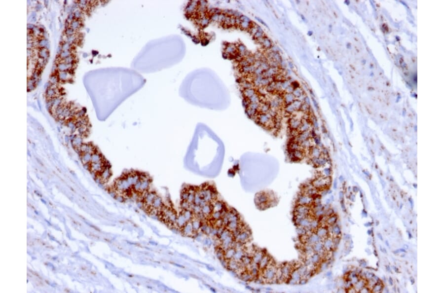 Immunohistochemistry - Anti-PMEPA1 Antibody [PMEPA1/2696] (A249756) - Antibodies.com