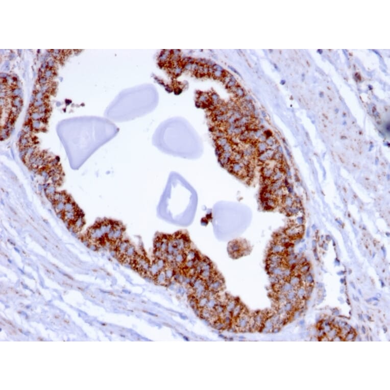 Immunohistochemistry - Anti-PMEPA1 Antibody [PMEPA1/2696] (A249756) - Antibodies.com