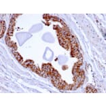Immunohistochemistry - Anti-PMEPA1 Antibody [PMEPA1/2696] (A249756) - Antibodies.com