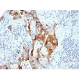 Immunohistochemistry - Anti-PMEPA1 Antibody [PMEPA1/2696] (A249756) - Antibodies.com