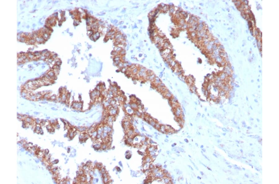 Immunohistochemistry - Anti-PMEPA1 Antibody [PMEPA1/2696] (A249756) - Antibodies.com