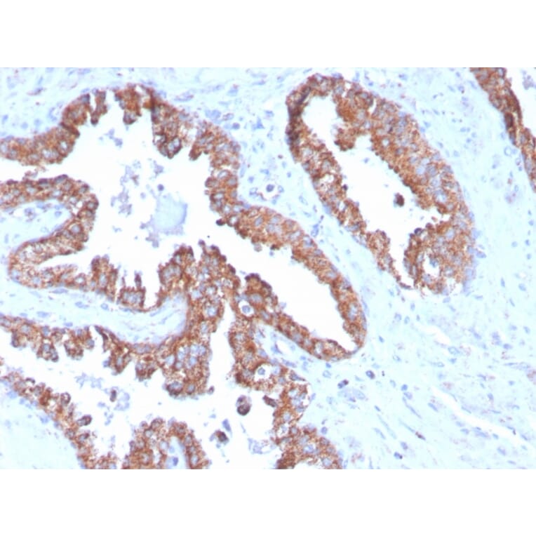 Immunohistochemistry - Anti-PMEPA1 Antibody [PMEPA1/2696] (A249756) - Antibodies.com