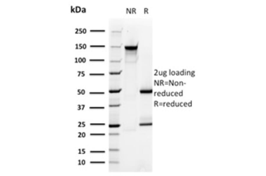 SDS-PAGE - Anti-PMEPA1 Antibody [PMEPA1/2696] (A249756) - Antibodies.com