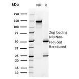 SDS-PAGE - Anti-PMEPA1 Antibody [PMEPA1/2696] (A249756) - Antibodies.com