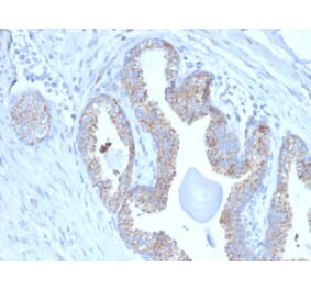 Immunohistochemistry - Anti-PMEPA1 Antibody [PMEPA1/2697] (A249757) - Antibodies.com