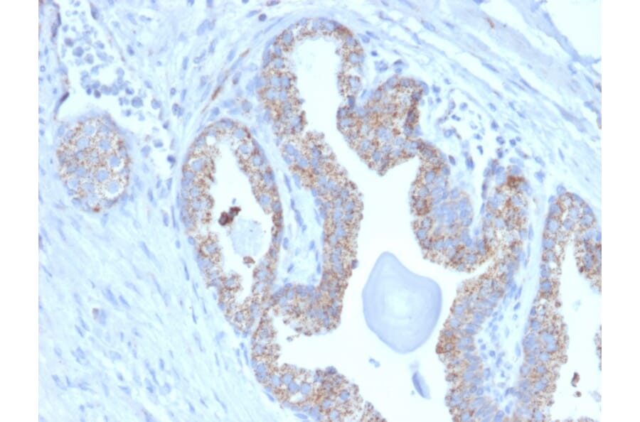 Immunohistochemistry - Anti-PMEPA1 Antibody [PMEPA1/2697] (A249757) - Antibodies.com