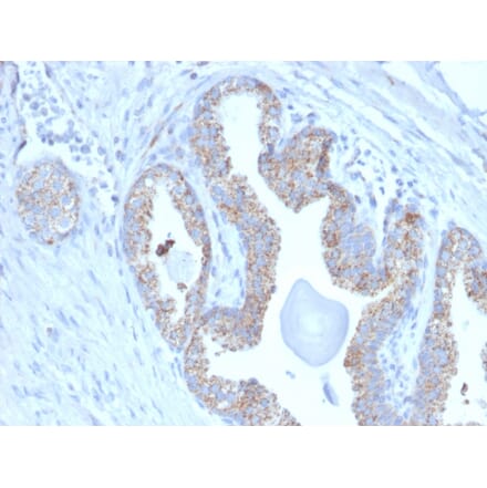 Immunohistochemistry - Anti-PMEPA1 Antibody [PMEPA1/2697] (A249757) - Antibodies.com