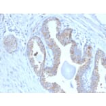 Immunohistochemistry - Anti-PMEPA1 Antibody [PMEPA1/2697] (A249757) - Antibodies.com