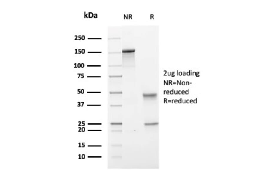 SDS-PAGE - Anti-PMEPA1 Antibody [PMEPA1/2697] (A249757) - Antibodies.com