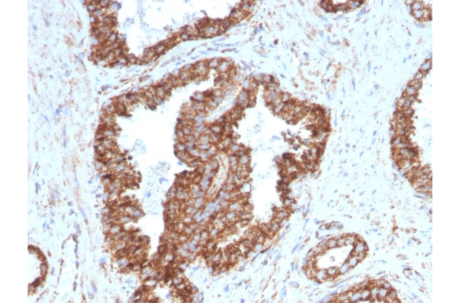 Immunohistochemistry - Anti-PMEPA1 Antibody [PMEPA1/2698] (A249758) - Antibodies.com