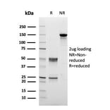 SDS-PAGE - Anti-PMEPA1 Antibody [PMEPA1/2698] (A249758) - Antibodies.com