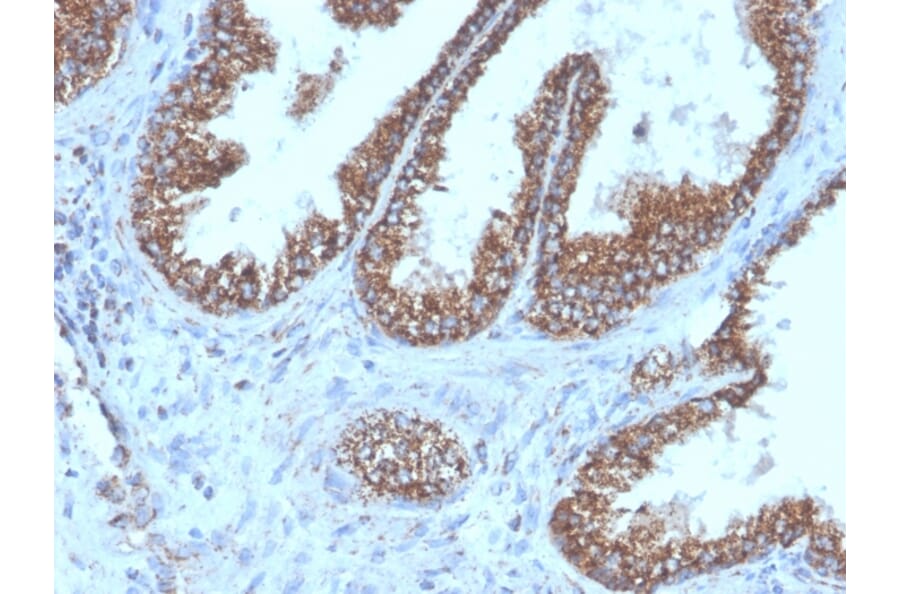 Immunohistochemistry - Anti-PMEPA1 Antibody [PMEPA1/6421R] (A249758) - Antibodies.com