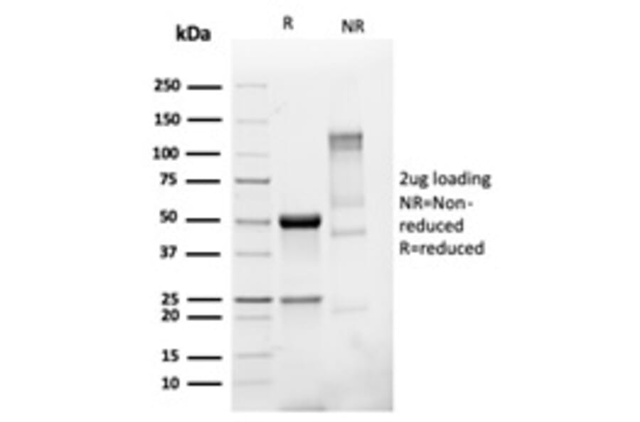 SDS-PAGE - Anti-PMEPA1 Antibody [PMEPA1/6421R] (A249759) - Antibodies.com