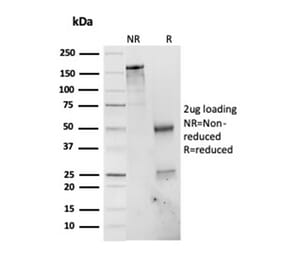 SDS-PAGE - Anti-PSMD4 Antibody [CPTC-PSMD4-3] (A249760) - Antibodies.com