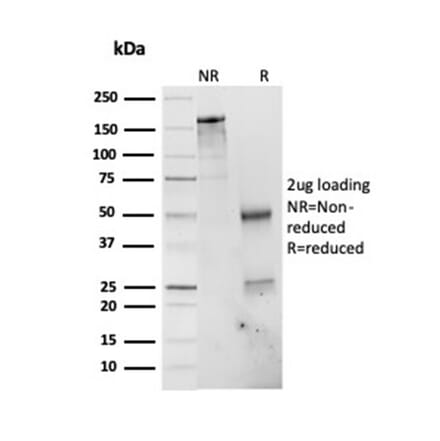 SDS-PAGE - Anti-PSMD4 Antibody [CPTC-PSMD4-3] (A249760) - Antibodies.com