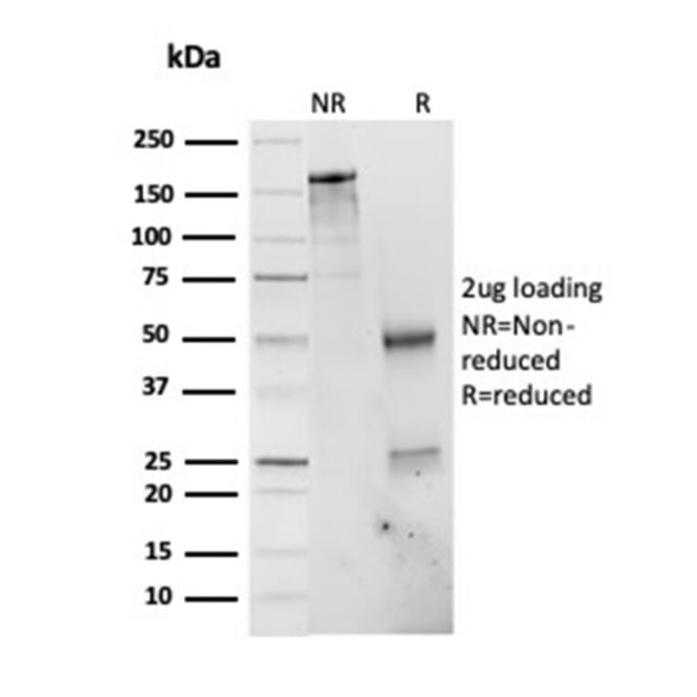 SDS-PAGE - Anti-PSMD4 Antibody [CPTC-PSMD4-3] (A249760) - Antibodies.com