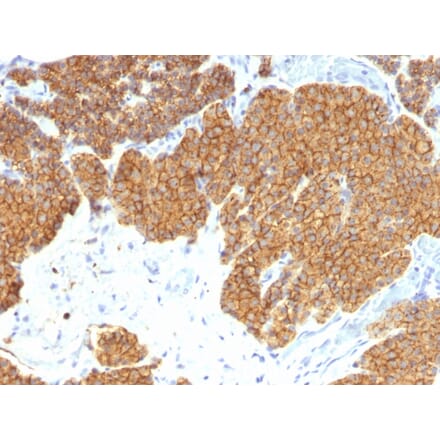 Immunohistochemistry - Anti-Parathyroid Hormone Antibody [3H9] (A249760) - Antibodies.com