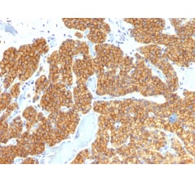 Immunohistochemistry - Anti-Parathyroid Hormone Antibody [PTH/911] (A249762) - Antibodies.com