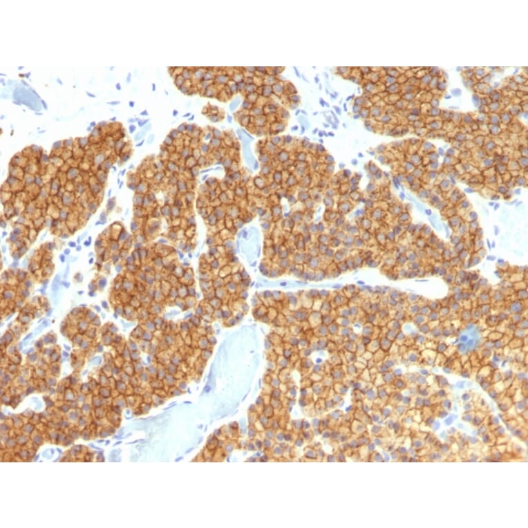 Immunohistochemistry - Anti-Parathyroid Hormone Antibody [PTH/911] (A249762) - Antibodies.com