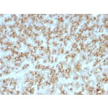 Immunohistochemistry - Anti-Parathyroid Hormone Antibody [PTH/911] (A249761) - Antibodies.com