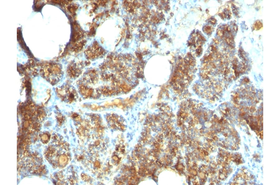 Immunohistochemistry - Anti-Parathyroid Hormone Antibody [PTH/1173] (A249764) - Antibodies.com