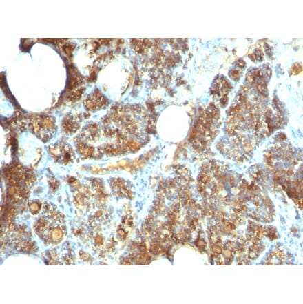 Immunohistochemistry - Anti-Parathyroid Hormone Antibody [PTH/1173] (A249764) - Antibodies.com