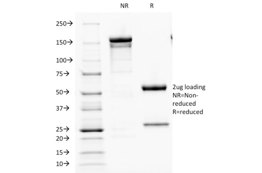 SDS-PAGE - Anti-Parathyroid Hormone Antibody [PTH/1173] (A249764) - Antibodies.com