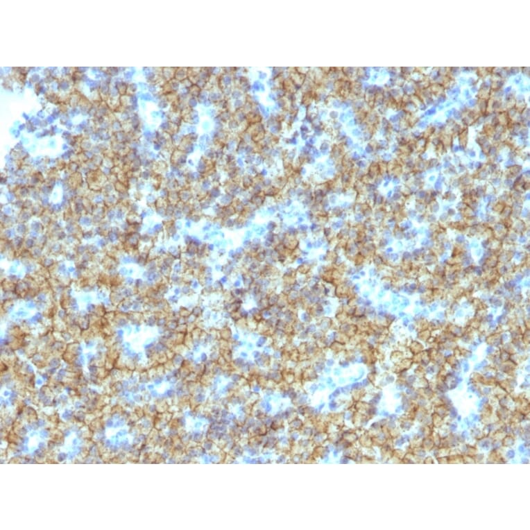 Immunohistochemistry - Anti-Parathyroid Hormone Antibody [PTH/1174] (A249765) - Antibodies.com