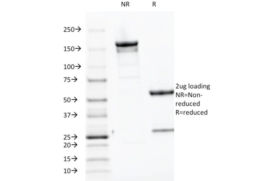 SDS-PAGE - Anti-Parathyroid Hormone Antibody [PTH/1174] (A249765) - Antibodies.com