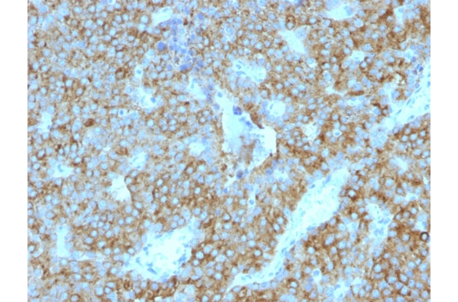 Immunohistochemistry - Anti-Parathyroid Hormone Antibody [PTH/1175] (A249765) - Antibodies.com
