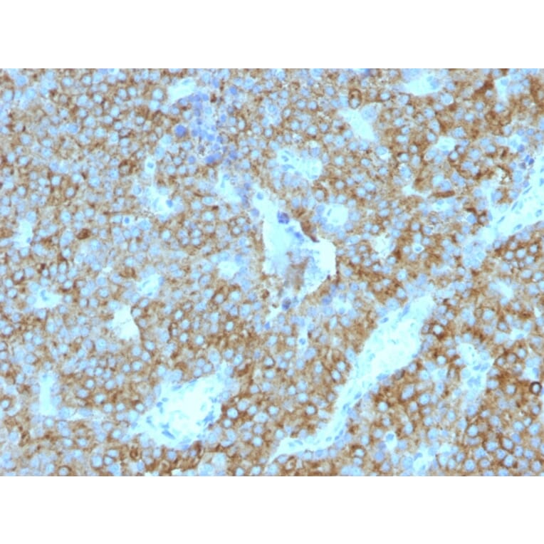 Immunohistochemistry - Anti-Parathyroid Hormone Antibody [PTH/1175] (A249765) - Antibodies.com