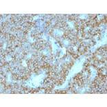 Immunohistochemistry - Anti-Parathyroid Hormone Antibody [PTH/1175] (A249765) - Antibodies.com