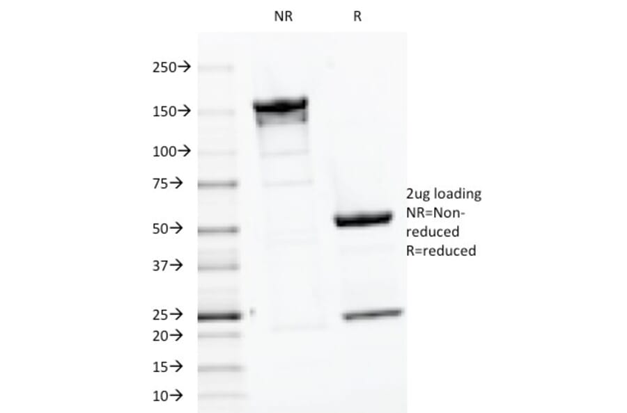 SDS-PAGE - Anti-Parathyroid Hormone Antibody [PTH/1175] (A249766) - Antibodies.com