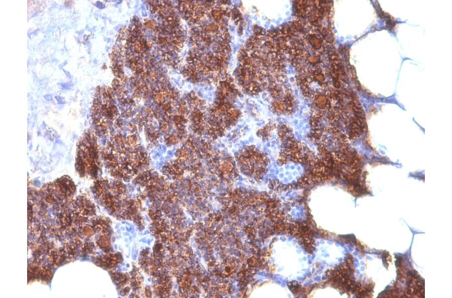 Immunohistochemistry - Anti-Parathyroid Hormone Antibody [3H9 + PTH/1175] (A249766) - Antibodies.com