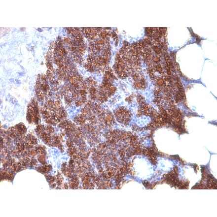 Immunohistochemistry - Anti-Parathyroid Hormone Antibody [3H9 + PTH/1175] (A249766) - Antibodies.com