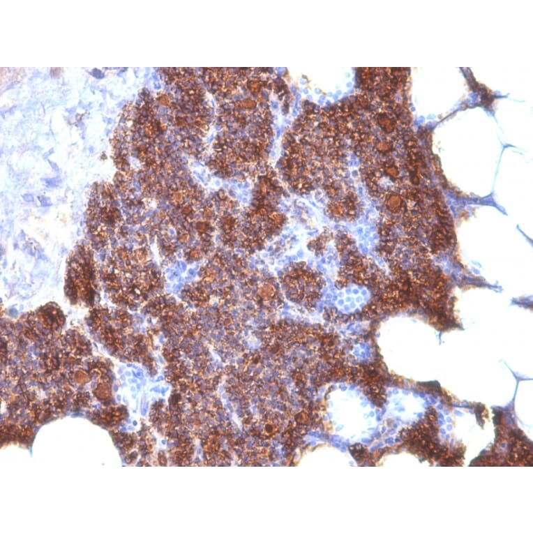 Immunohistochemistry - Anti-Parathyroid Hormone Antibody [3H9 + PTH/1175] (A249766) - Antibodies.com