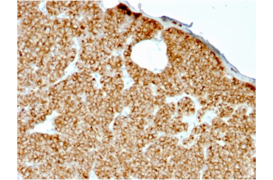 Immunohistochemistry - Anti-Parathyroid Hormone Antibody [rPTH/911] (A249767) - Antibodies.com