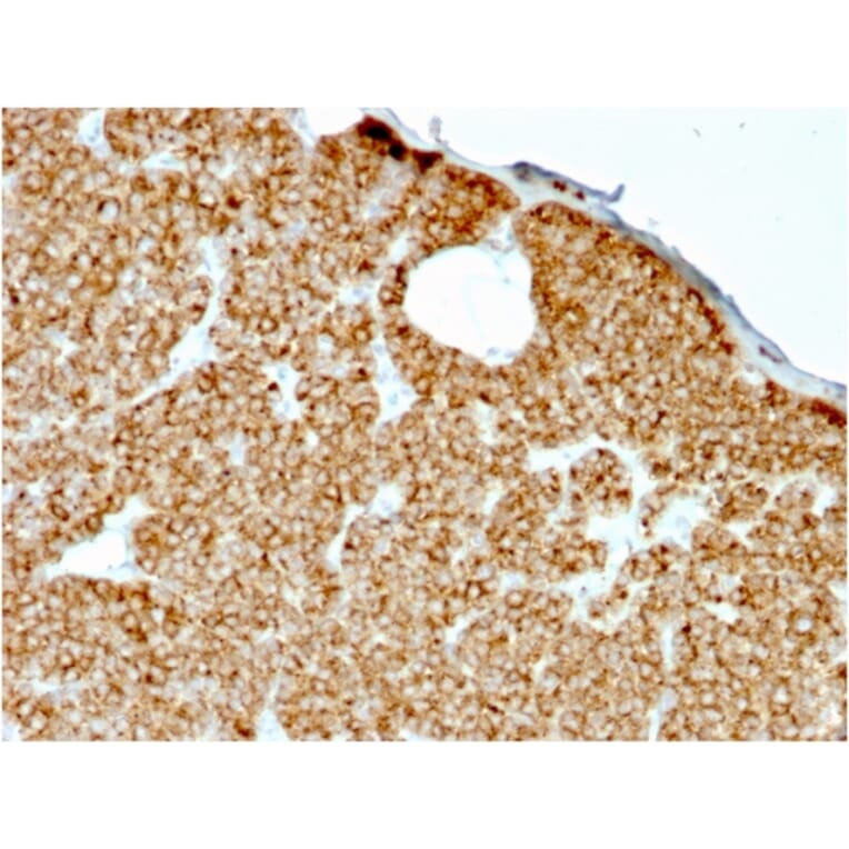 Immunohistochemistry - Anti-Parathyroid Hormone Antibody [rPTH/911] (A249767) - Antibodies.com