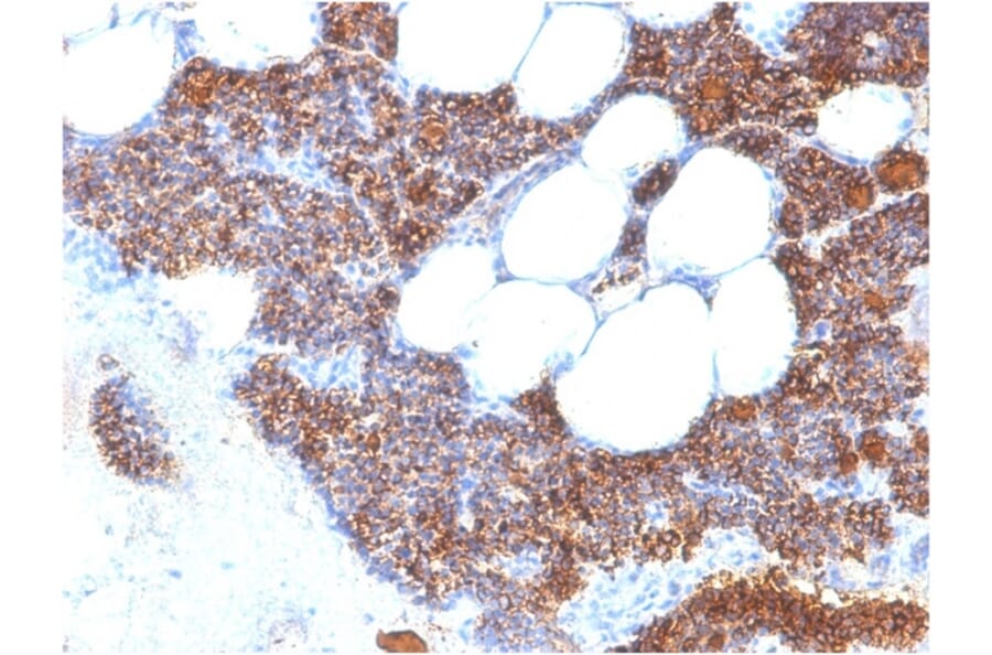 Immunohistochemistry - Anti-Parathyroid Hormone Antibody [PTH/2295R] (A249769) - Antibodies.com